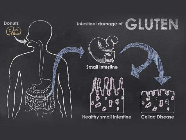 An infographic showing the ingestion of gluten into a body and its affect on the small intestine, all on a chalkboard